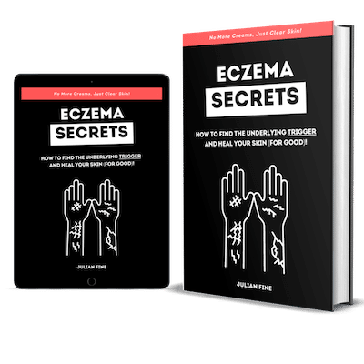Best Eczema Book: Eczema Secrets by Julian Fine 
