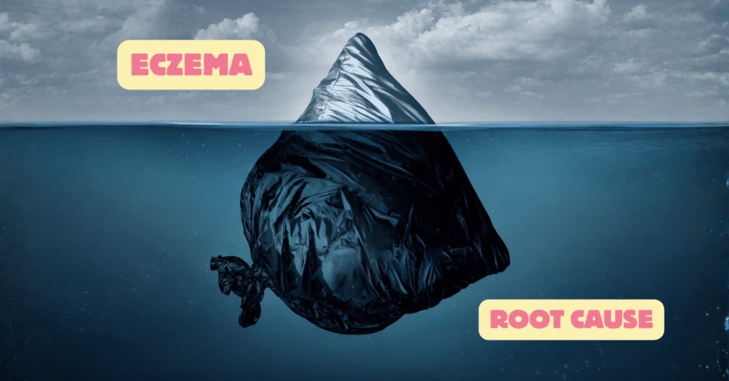 EczPro - Eczema Root Cause